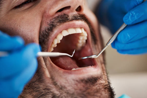 Best Emergency Gum Pain Relief  in Evart, MI